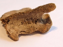 Shoulder blade of infant with scurvy